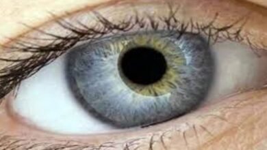 آنکھوں میں کالا موتیا کا خطرہ کیسے کم کیا جائے؟