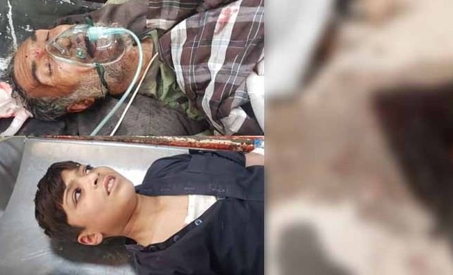 کوئٹہ: پشتون آباد میں دستی بم دھماکے سے 7 افراد زخمی